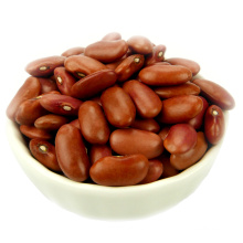 britain dard red kidney beans